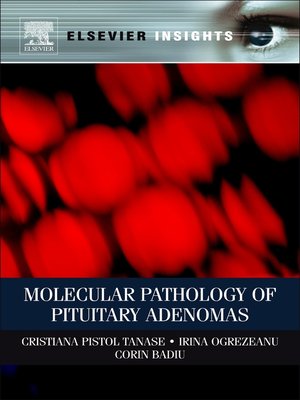 cover image of Molecular Pathology of Pituitary Adenomas